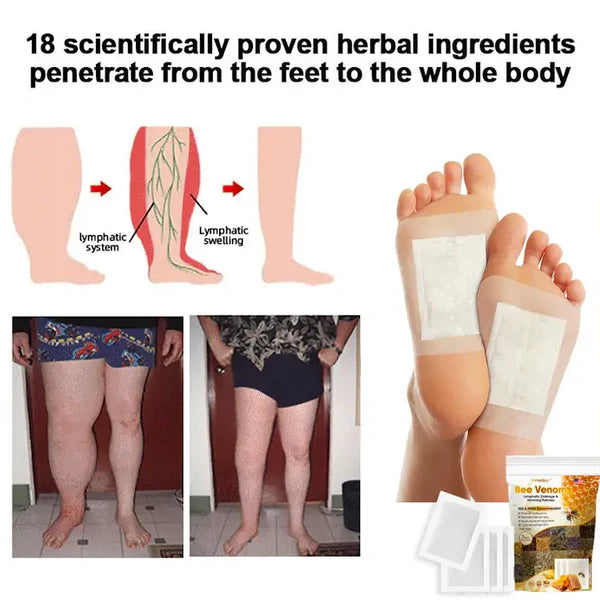 Bee Venom Lymphatic Drainage & Slimming Foot Patches πΏπ£ (BUY 1 GET 1 FREE)